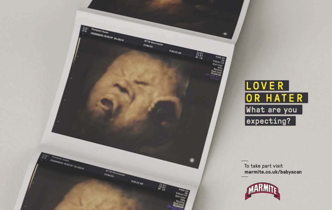 Baby sonogram pictures ad info and link to landing page